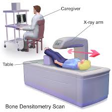 سنجش تراکم استخوان , سنجش پوکی استخوان ,bone densitometry